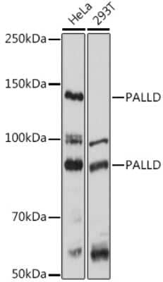 Western Blot Palladin Antibody - Azide and BSA Free